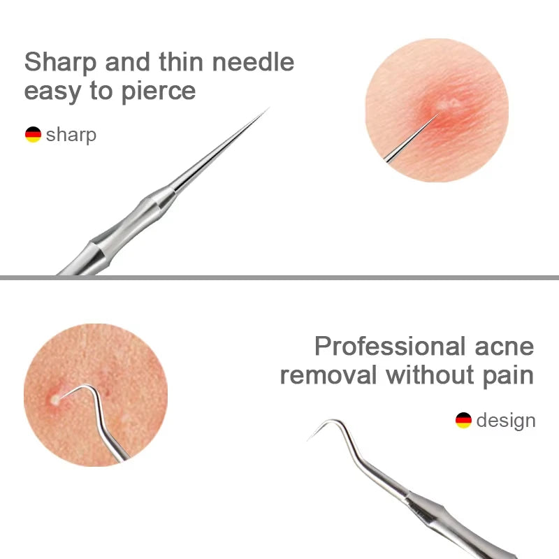 German Acne Blackhead Removal Needles Pimples Blackhead Clip Tweezers Beauty Artifact Blemish Extractor Remover Needle Tool 2026
