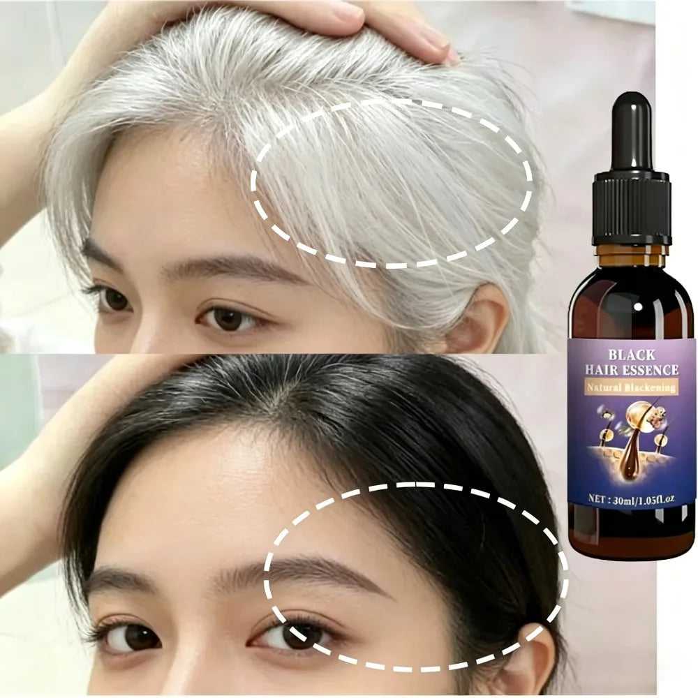 Hair Strengthening Black Essence - Balances Scalp Oil & Unclogs Follicles, Improves Hair Shine.