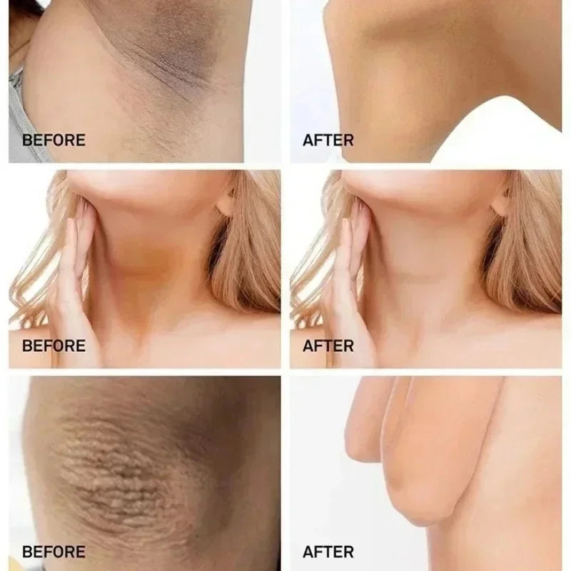 Dark Spot Correcting Body Serum | Underarm & Inner Thigh Skin Tone Care