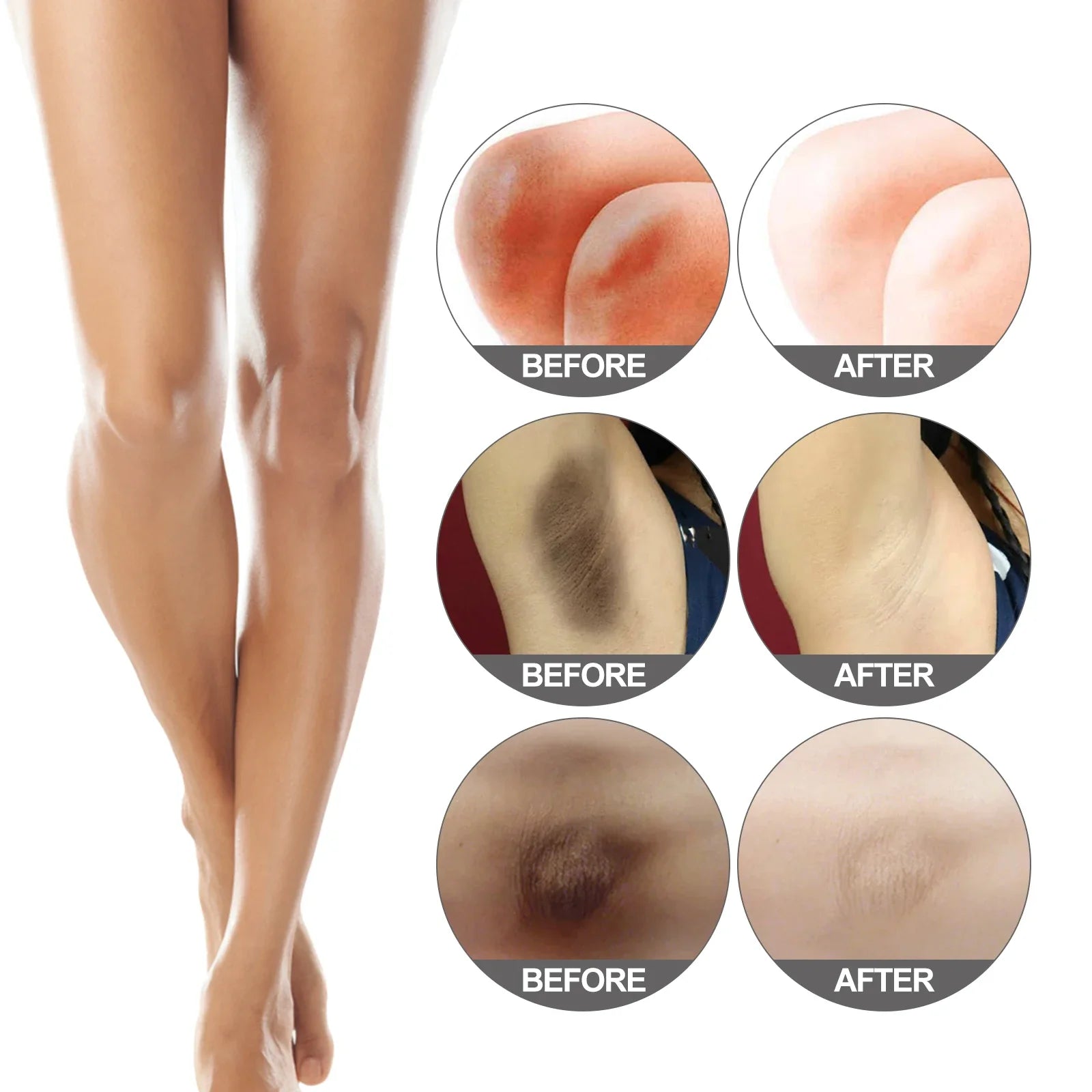Whitening Body Cream Moisturizing Reduce Dullness Remove Dark Spot Smoothing Softening Body Cream for Joint Armpit Knee