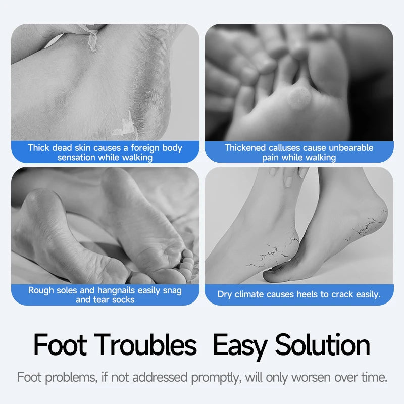 Waterproof Electric Foot File Callus Remover