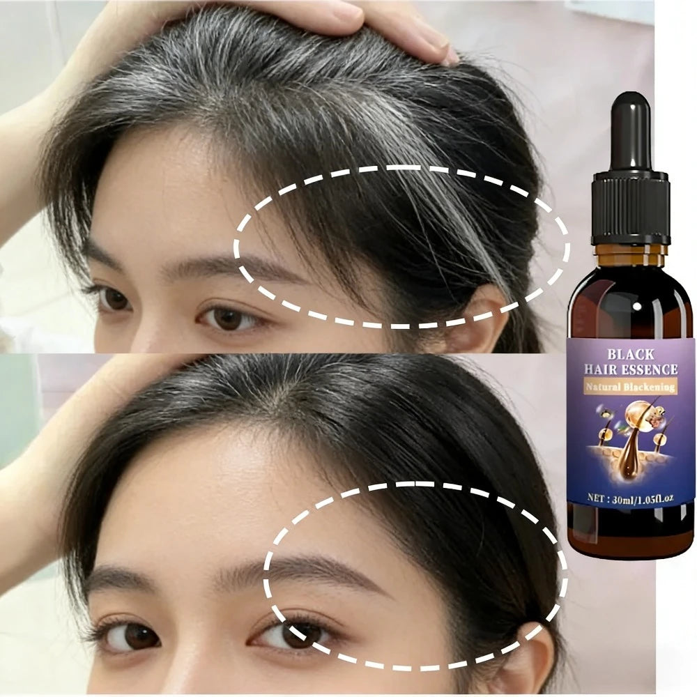 Hair Strengthening Black Essence - Balances Scalp Oil & Unclogs Follicles, Improves Hair Shine.