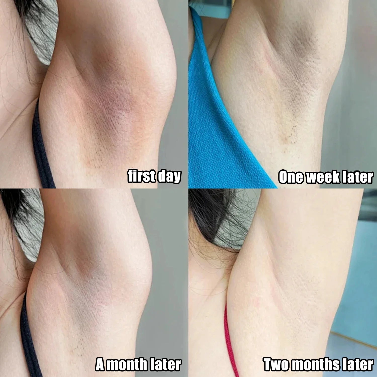 Dark Spot Correcting Body Serum | Underarm & Inner Thigh Skin Tone Care