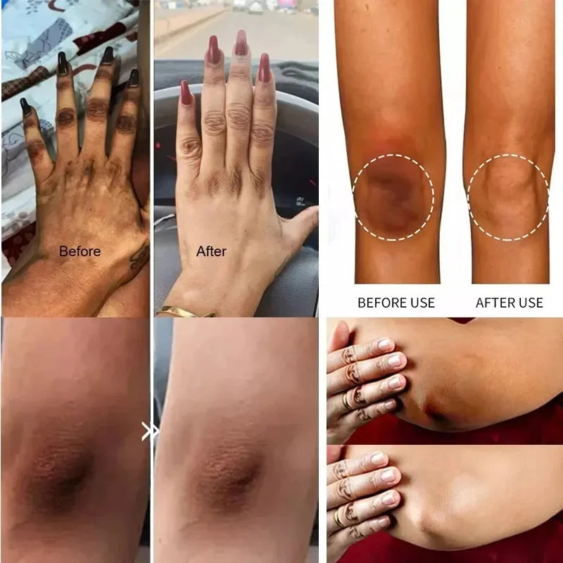 Dark Spot Correcting Body Serum | Underarm & Inner Thigh Skin Tone Care