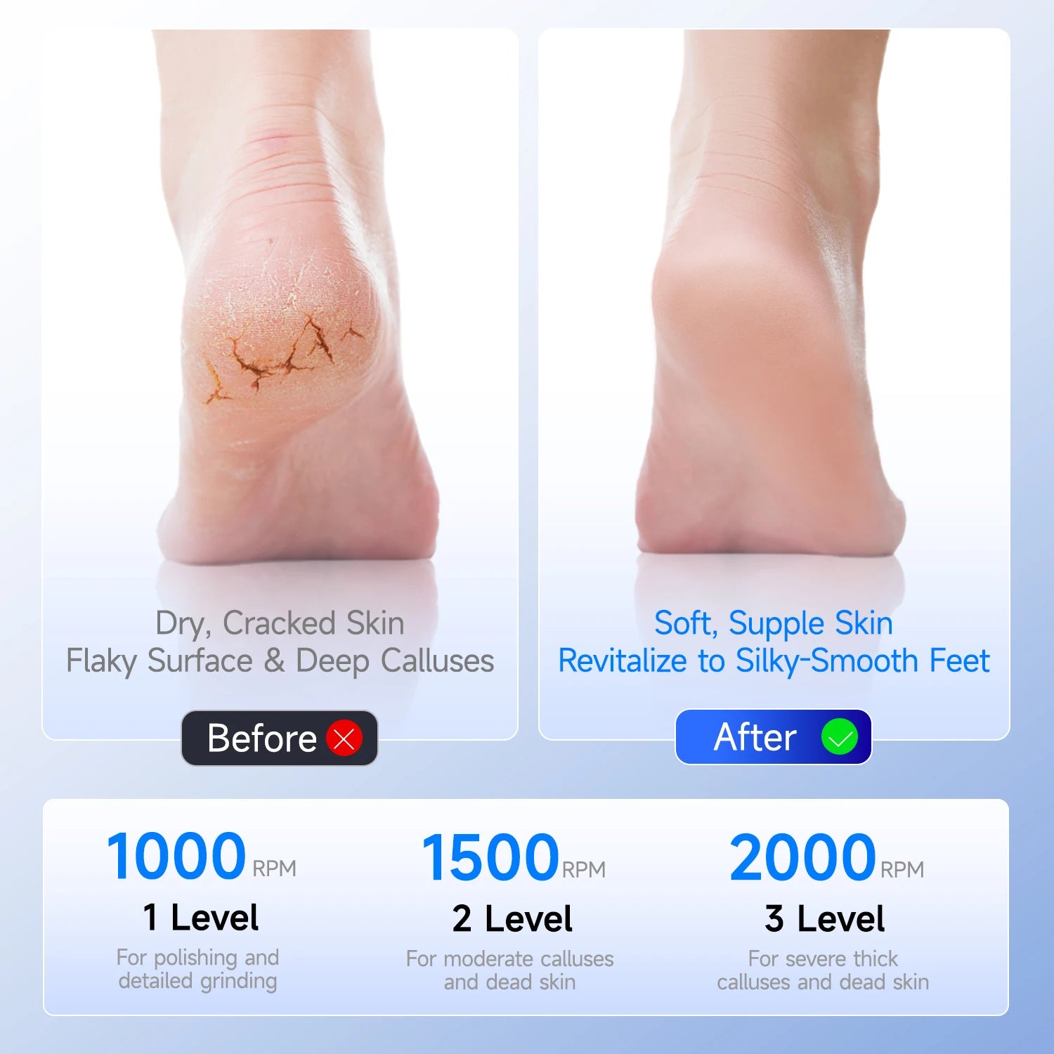 Waterproof Electric Foot File Callus Remover