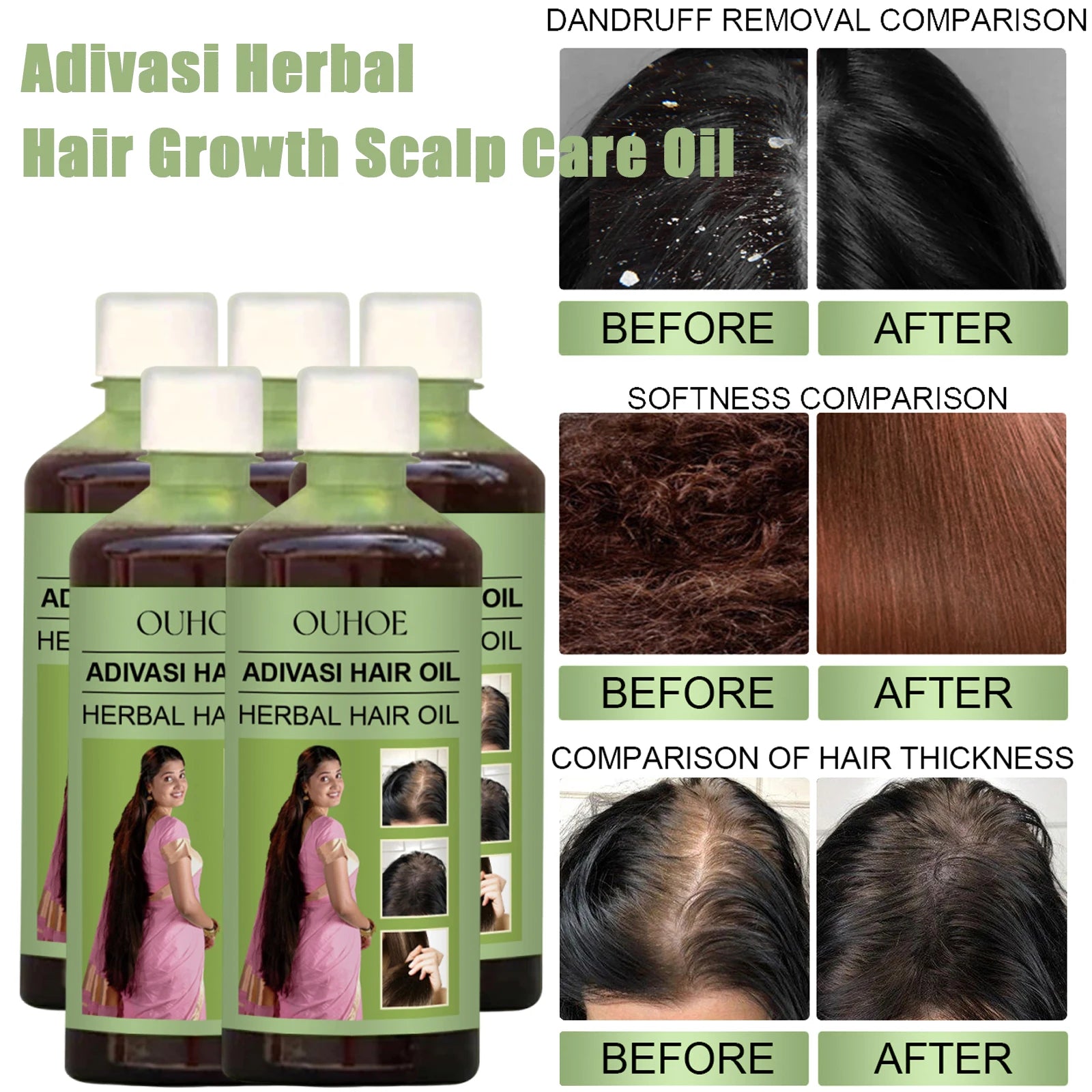 100ml Adivasi Herbal Hair Growth Oil