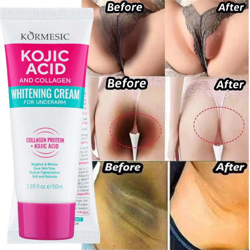 Dark Spot Correcting Body Serum | Underarm & Inner Thigh Skin Tone Care