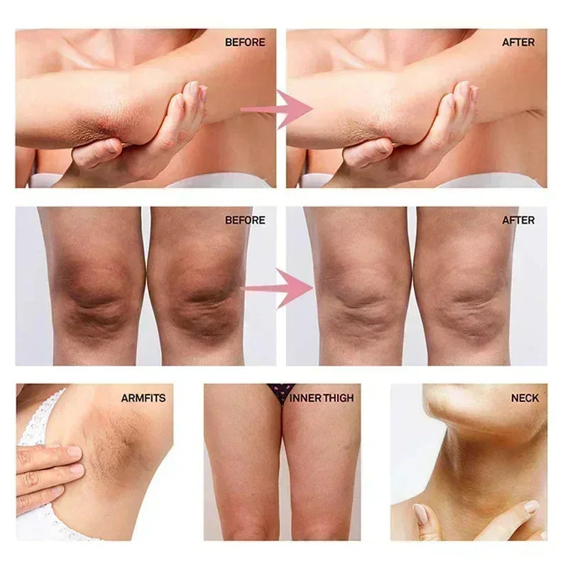 Dark Spot Correcting Body Serum | Underarm & Inner Thigh Skin Tone Care