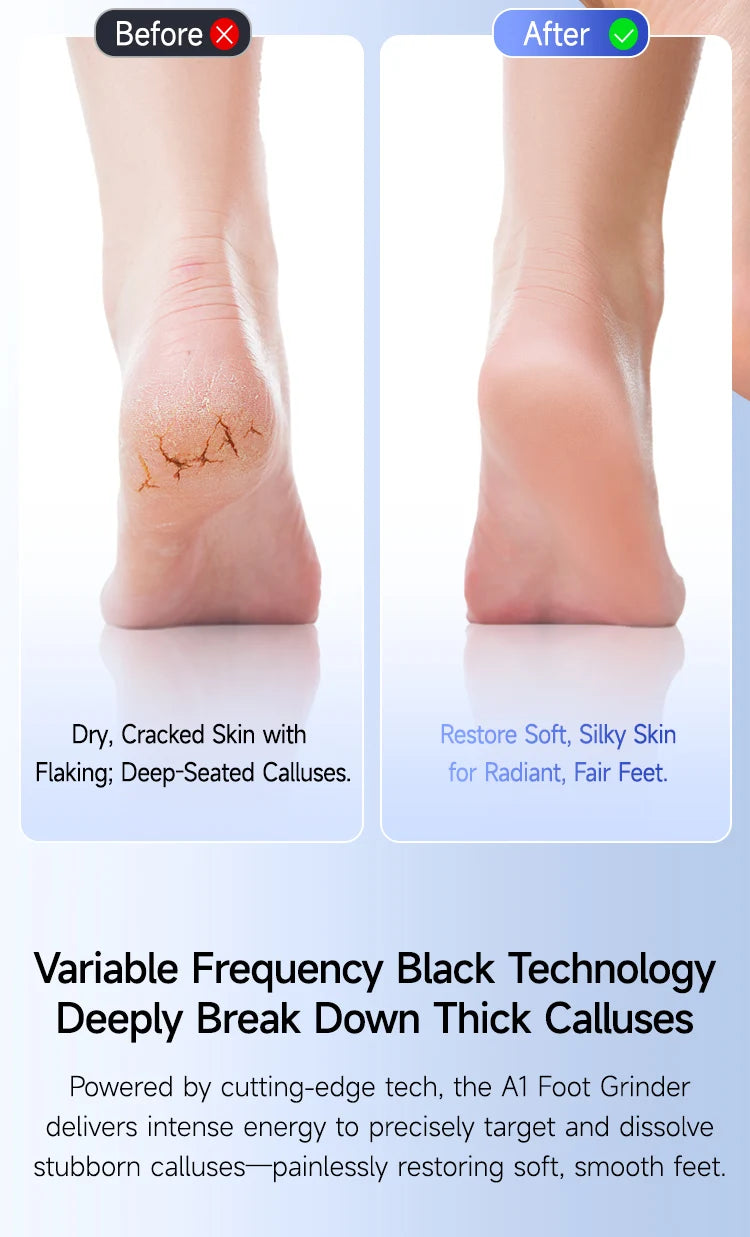 Waterproof Electric Foot File Callus Remover